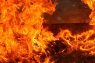 Волинянка отримала 50% опіків тіла внаслідок пожежі