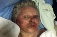 Повідомили про стан жінки, яку знайшли непритомною на березі Стиру у Луцьку (фото)