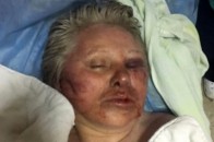 Родичі впізнали жінку, котру знайшли в Луцьку на березі річки Стир