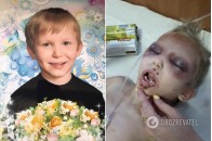 Колола голкою, різала тіло і забороняла плакати: мати по-звірячому знущалася над маленьким сином (фото 18+)