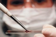 Вчені з'ясували, які групи крові притягують хвороби