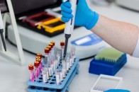 Волинян закликають перевірити імунітет до небезпечних хвороб