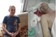 Чоловіку раптом стало погано і він впав − сім'я бореться за життя волинянина