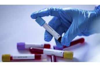 Скільки тестів на виявлення коронавірусу наразі є в Україні