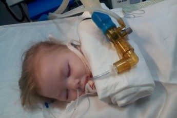 Головні новини Волині 24 лютого: померла 2-річна дівчинка, яку паралізувало після пневмонії; за головною муніципалкою Луцька стежать невідомі на…