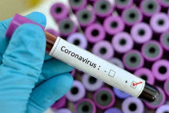 Ще одна область в Україні йде на карантин через смертоносний коронавірус