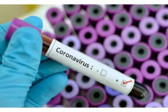 Відомі результати тесту іноземця, якого госпіталізували у Луцьку з підозрою на коронавірус