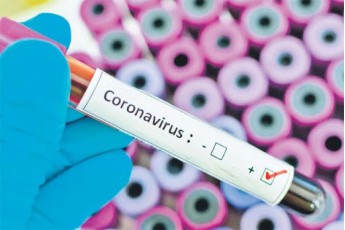 Позитивний результат тесту: у волинянина виявили коронавірус
