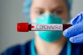 Повідомили результати лабораторних аналізів волинського бізнесмена, у якого експрес-тест показав діагноз коронавірусу