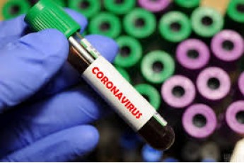У волинянина експрес-тест підтвердив коронавірус