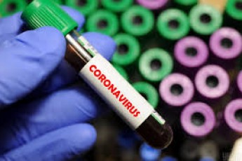 Головні новини Волині 28 березня: у волинянина експрес-тест підтвердив коронавірус; у Луцьку чоловік в аптеці вкрав таблетки