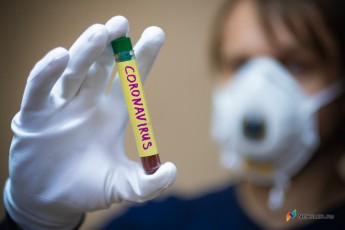 На Волині у 42-річної жінки виявили коронавірус