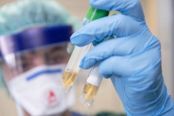 Серед медиків на Рівненщині зафіксували нові випадки інфікування коронавірусом