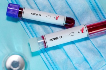 У Луцьку збільшилася кількість випадків захворюваності на COVID-19