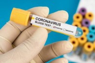 У Луцьку зафіксовано майже 30 випадків захворювання на COVID-19