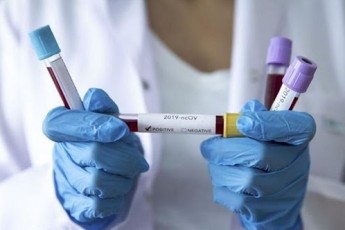 У головного держінспектора Поліської митниці виявили коронавірус