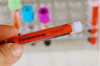 У місті на Волині виявили ще п'ятеро хворих на коронавірус, серед них – маленька дитина та лікар