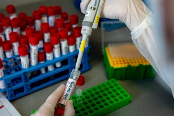 В Україні розробляють нові тести на імунітет до COVID-19