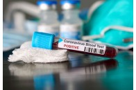 Головні новини Волині 27 квітня: волинянка, яка інфікувалася коронавірусом у лікарні, їздила на Великдень додому; у Луцьку на хабарі викрили заступницю…