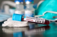 Коронавірус в Україні: яка кількість хворих на COVID-19 по областях