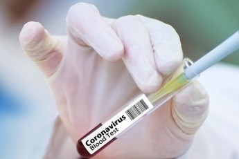 Головні новини Волині 3 травня: зросла кількість інфікованих коронавірусом; чоловік у балаклаві спалив свою 