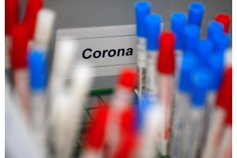 Краще за ПЛР: медик назвала найправдивіший тест на коронавірус