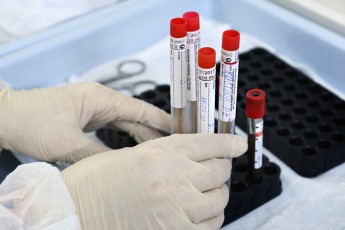 Два нових випадки коронавірусу на Волині: захворіли працівники птахофабрики (оновлено)