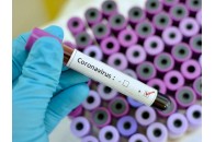 У волинському селищі посилили карантин для локалізації вогнища коронавірусу