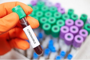 У місті на Волині виявили нових хворих на коронавірус та понад 230 – очікують на результати