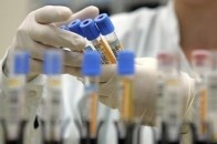 У Луцьку зафіксували нові випадки захворювання на COVID-19
