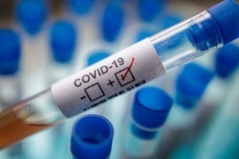 У Луцьку зафіксували ще 9 випадків захворювання на COVID-19