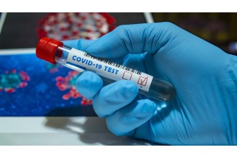 Антитіла до коронавірусу зникають: вчені попередили про нову небезпеку