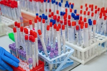 Українців обов'язково тестуватимуть на коронавірус