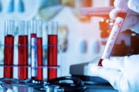 Коронавірус в Україні за добу виявили у майже 700 людей: статистика МОЗ на 22 червня