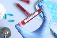 Головні новини Волині 24 червня: інфікована працівниця луцького підприємства ігнорувала коронавірус; у страшній аварії загинув чоловік