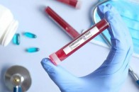 Нові дані МОЗ: в Україні зафіксовано нові 994 випадки COVID-19