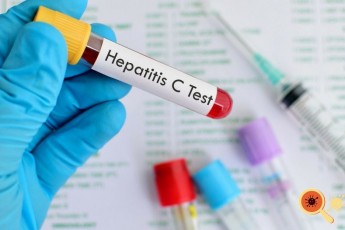 На Волині зафіксували 2 випадки гепатиту А, один із захворілих − підліток