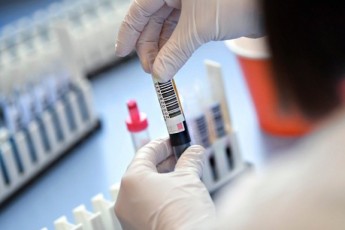 В Україні змінили протокол лікування коронавірусу