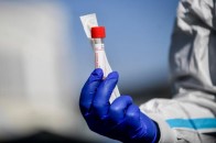 В Україні чоловік втретє заразився коронавірусом