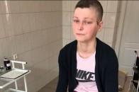 Молода волинянка втратила ногу в боротьбі з раком, потрібна допомога