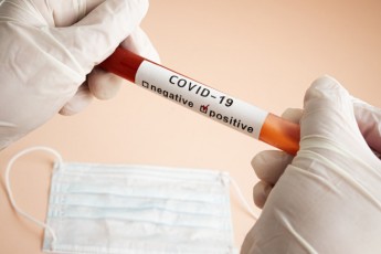 Одна смерть: де на Волині за добу виявили найбільше хворих на коронавірус (статистика по районах)
