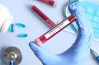 Коронавірус не відступає: за добу в Україні зафіксували понад тисячу нових випадків