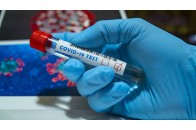 В Україні за добу підтвердили 2495 випадків COVID-19, з них на Волині – 66