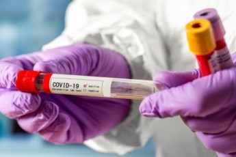 На Волині за добу зафіксували понад 60 нових випадків коронавірусу, дві людини померли (статистика по районах)