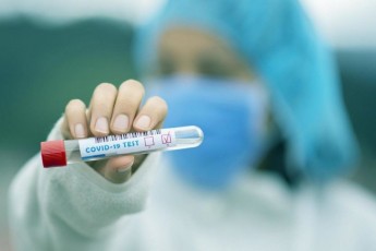 Медиків змушують приховувати коронавірус: Зеленський доручив МОЗ розібратися