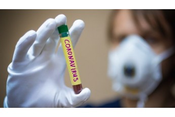 В Україні за добу зафіксували понад 3 тисячі нових випадків коронавірусу, на Волині – 96