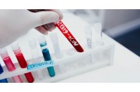 Коронавірус в Україні: зафіксовано понад 3200 інфікованих та майже пів сотні летальних випадків