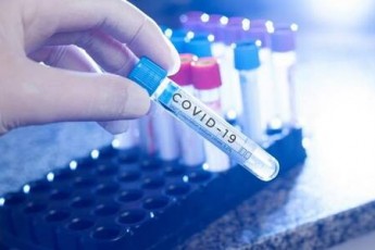 В Україні кількість випадків COVID-19 трохи зменшилася: за добу виявили понад 4100 хворих