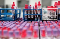 Майже 5 тисяч волинян хворіють на COVID-19: де виявили спалахи