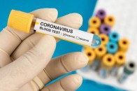 У МОЗ назвали регіони, де не встигають перевіряти тести на коронавірус